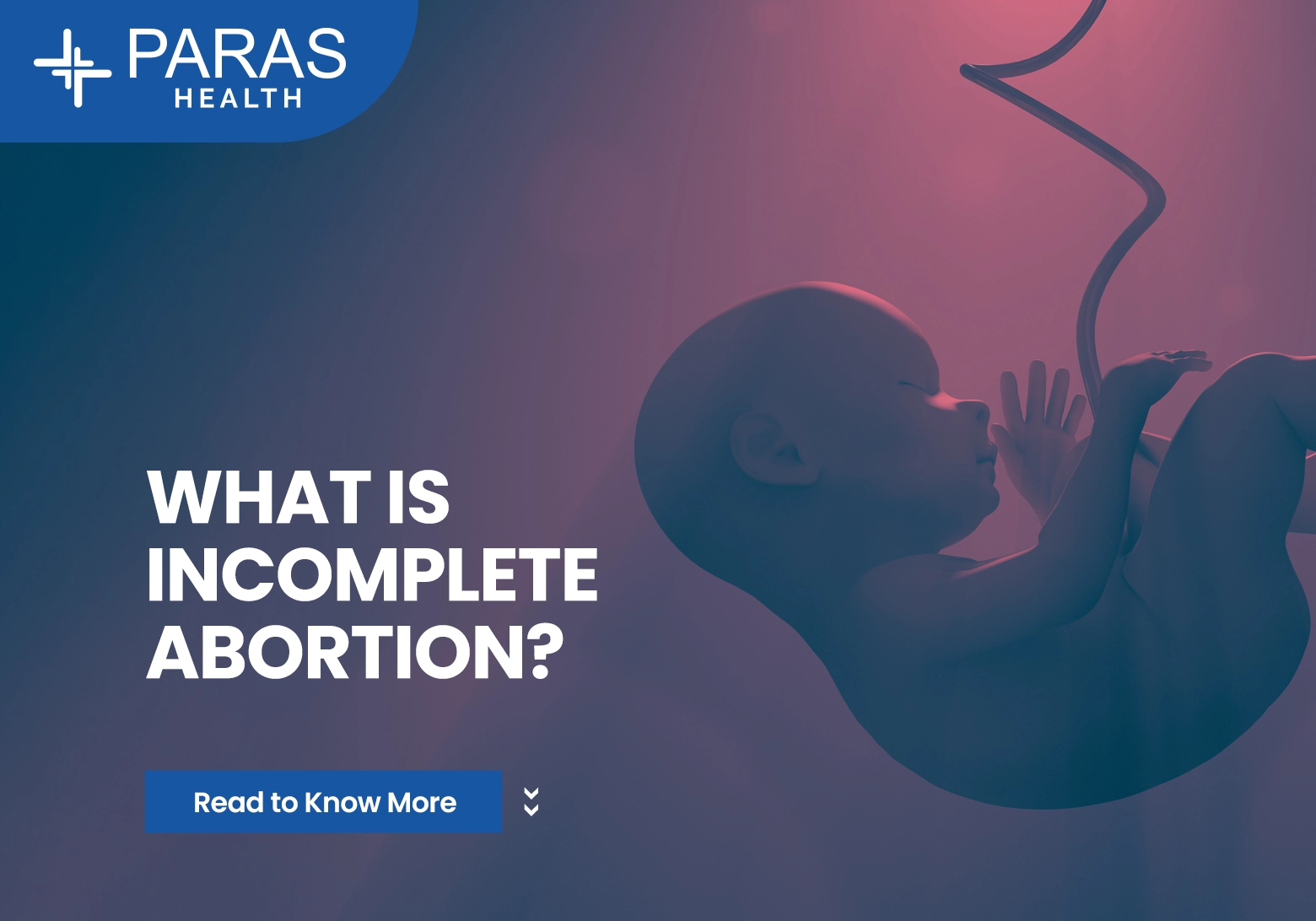 What is Incomplete Abortion?
